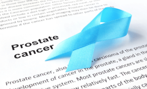 Woodlands Urology Prostate Cancer Screening